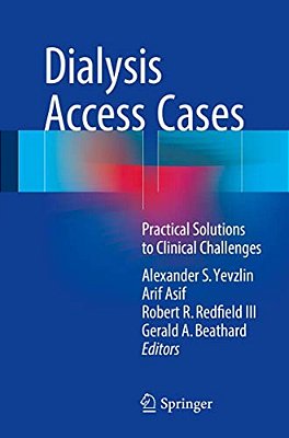 Dialysis Access Cases: Practical Solutions To Clinical Challenges-..