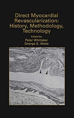 Direct Myocardial Revascularization: History, Methodology, Technology-..