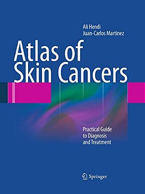 Atlas Of Skin Cancers: Practical Guide To Diagnosis And Treatment-..