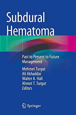 Subdural Hematoma: Past To Present To Future Management-..