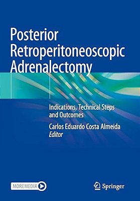 Posterior Retroperitoneoscopic Adrenalectomy: Indications, Technical Steps And Outcomes-..