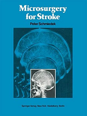 Microsurgery For Stroke-..