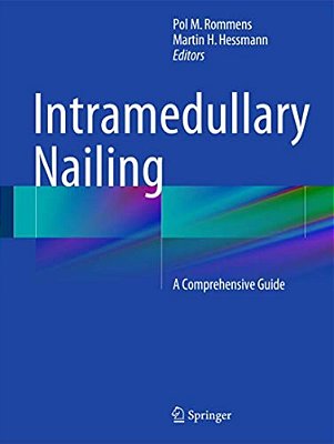 Intramedullary Nailing: A Comprehensive Guide-..
