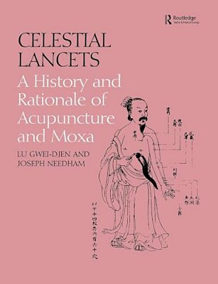 Celestial Lancets: A History And Rationale Of Acupuncture And Moxa-..