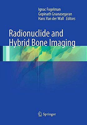 Radionuclide And Hybrid Bone Imaging-..