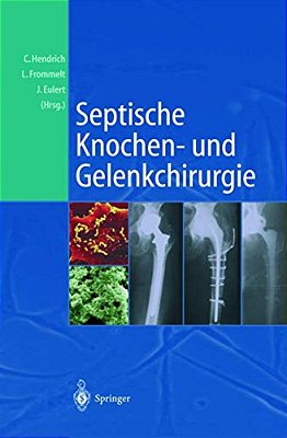 Septische Knochen-Und Gelenkchirurgie-..
