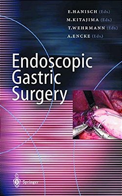 Endoscopic Gastric Surgery-..