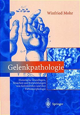 Gelenkpathologie: Historische Grundlagen, Ursachen Und Entwicklungen Von Gelenkleiden Und Ihre Pathomorphologie-..