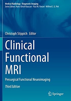 Clinical Functional Mri: Presurgical Functional Neuroimaging-..