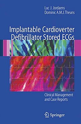 Implantable Cardioverter Defibrillator Stored Ecgs: Clinical Management And Case Reports-..