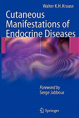 Cutaneous Manifestations Of Endocrine Diseases-..