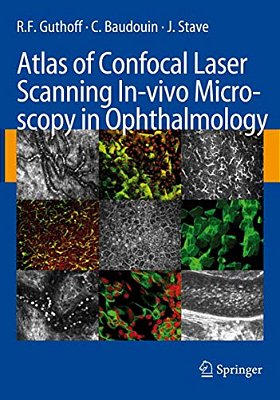 Atlas Of Confocal Laser Scanning In-Vivo Microscopy In Ophthalmology: Principles And Applications In Diagnostic And Therapeutic Ophtalmology-..