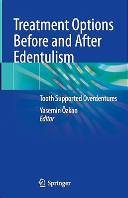 Treatment Options Before And After Edentulism: Tooth Supported Overdentures-..
