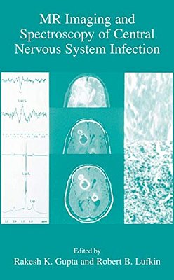 Mr Imaging And Spectroscopy Of Central Nervous System Infection-..