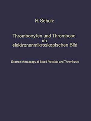 Thrombocyten Und Thrombose Im Elektronenmikroskopischen Bild/Electron Microscopy Of Blood Platelets And Thrombosis-..
