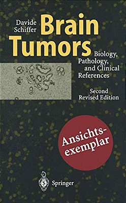 Brain Tumors: Biology, Pathology And Clinical References-..