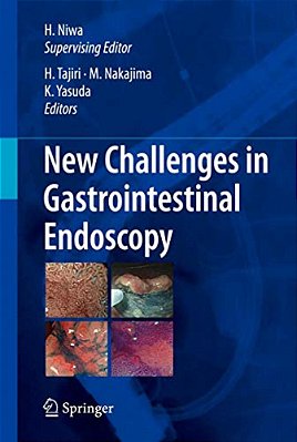 New Challenges In Gastrointestinal Endoscopy-..
