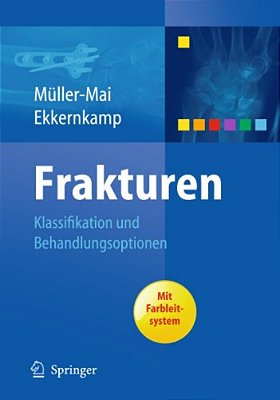 Frakturen: Klassifikation Und Behandlungsoptionen-..