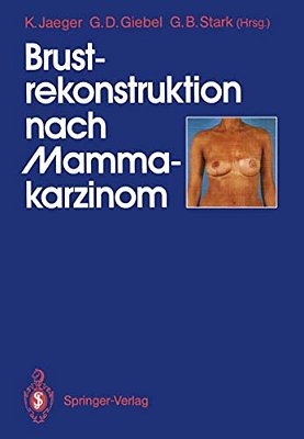 Brustrekonstruktion Nach Mammakarzinom-..
