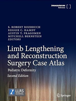 Limb Lengthening And Reconstruction Surgery Case Atlas: Pediatric Deformity-..