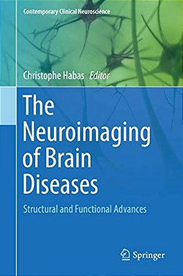 The Neuroimaging Of Brain Diseases: Structural And Functional Advances-..