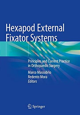 Hexapod External Fixator Systems: Principles And Current Practice In Orthopaedic Surgery-..