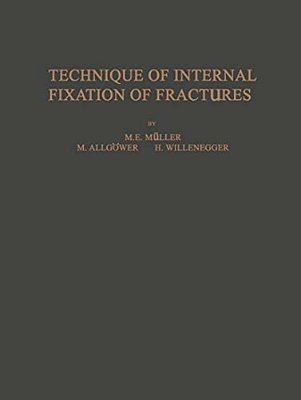 Technique Of Internal Fixation Of Fractures-..