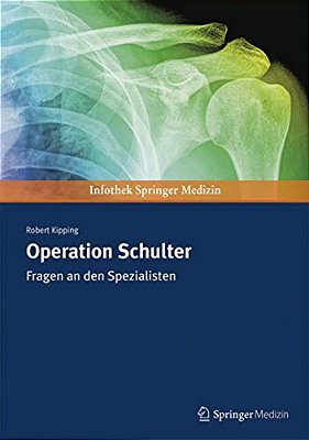Operation Schulter: Fragen An Den Spezialisten-..