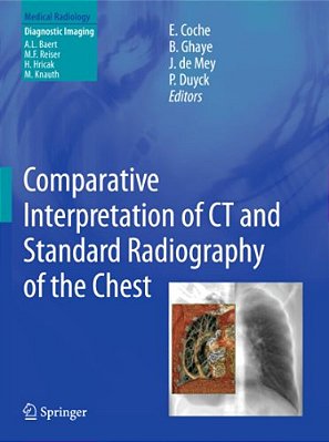 Comparative Interpretation Of Ct And Standard Radiography Of The Chest-..