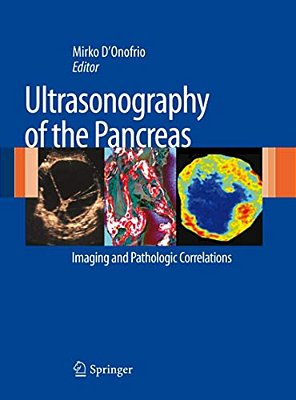 Ultrasonography Of The Pancreas: Imaging And Pathologic Correlations-..