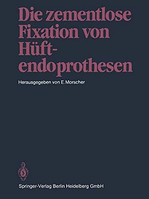 Die Zementlose Fixation Von Hüftendoprothesen-..