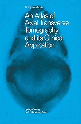 An Atlas Of Axial Transverse Tomography And Its Clinical Application-..