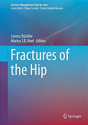 Fractures Of The Hip-..