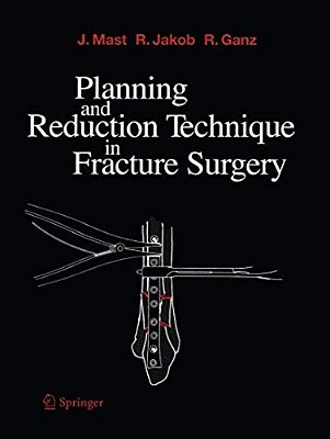 Planning And Reduction Technique In Fracture Surgery-..