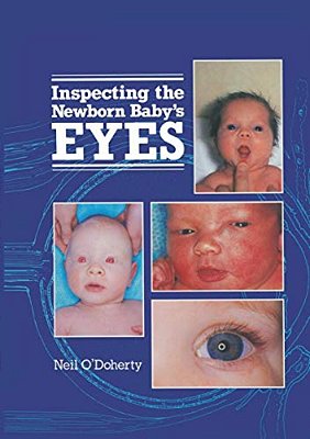 Inspecting The Newborn Baby's Eyes-..