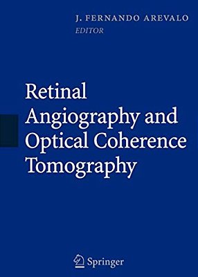 Retinal Angiography And Optical Coherence Tomography-..