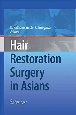 Hair Restoration Surgery In Asians-..