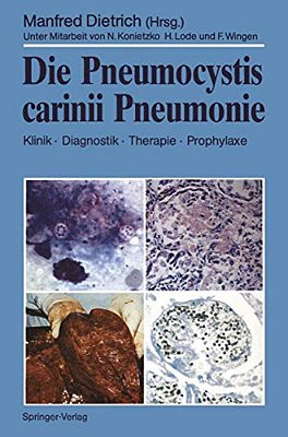 Die Pneumocystis Carinii Pneumonie: Klinik - Diagnostik - Therapie - Prophylaxe-..