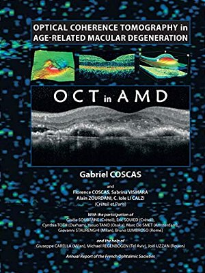 Optical Coherence Tomography In Age-Related Macular Degeneration-..
