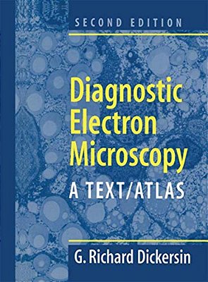 Diagnostic Electron Microscopy: A Text/Atlas-..