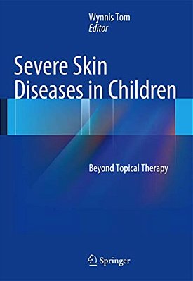 Severe Skin Diseases In Children: Beyond Topical Therapy-..