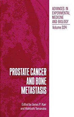 Prostate Cancer And Bone Metastasis-..