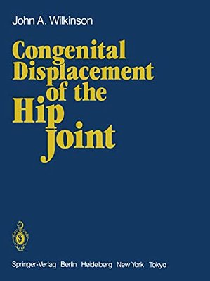 Congenital Displacement Of The Hip Joint-..