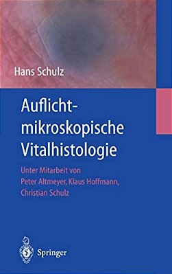 Auflichtmikroskopische Vitalhistologie: Dermatologischer Leitfaden-..