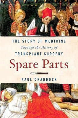 Spare Parts: The Story Of Medicine Through The History Of Transplant Surgery-..