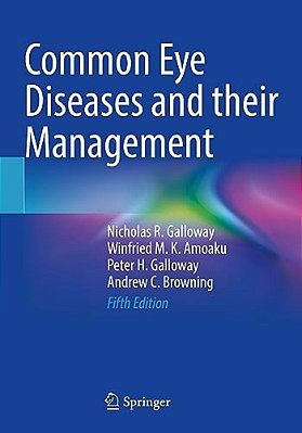 Common Eye Diseases And Their Management-..