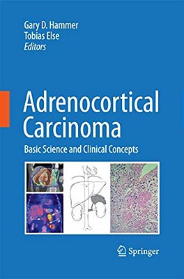 Adrenocortical Carcinoma: Basic Science And Clinical Concepts-..