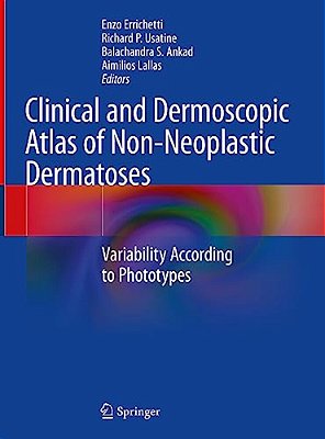 Clinical And Dermoscopic Atlas Of Non-Neoplastic Dermatoses: Variability According To Phototypes-..