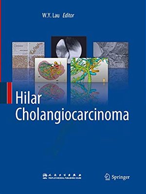 Hilar Cholangiocarcinoma-..
