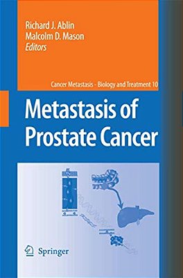 Metastasis Of Prostate Cancer-..